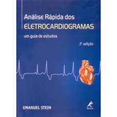 Análise rápida dos eletrocardiogramas