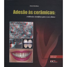 Adesão às Cerâmicas