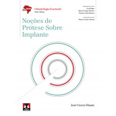 Noções de Prótese Sobre Implante