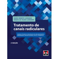 Tratamento de Canais Radiculares