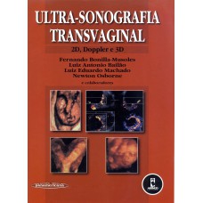 Ultrassonografia Transvaginal