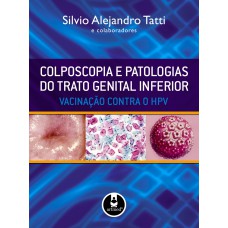 Colposcopia e Patologias do Trato Genital Inferior