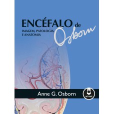 Encéfalo de Osborn