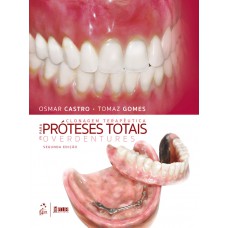 Clonagem Terapêutica para Próteses Totais e Overdentures Clonagem Terapêutica para Próteses Totais e Overdentures