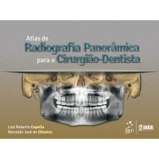 Atlas de Radiografia Panorâmica para o Cirurgião-Dentista