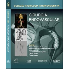 Cirurgia Endovascular