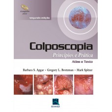 Colposcopia