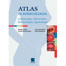 Atlas de Ginecologia