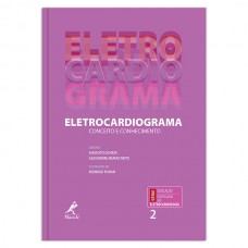 Eletrocardiograma