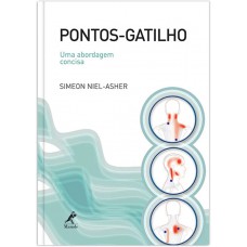 Pontos-gatilho