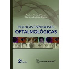 Doenças e síndromes oftalmológicas