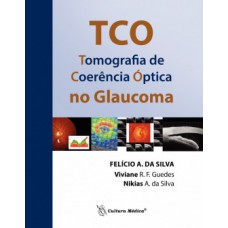 TCO - Tomografia de coerência óptica no glaucoma