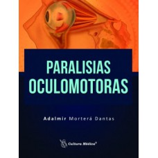 Paralisias oculomotoras