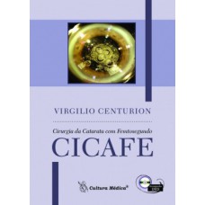 Cirurgia da catarata com femtosegundo (CICAFE)