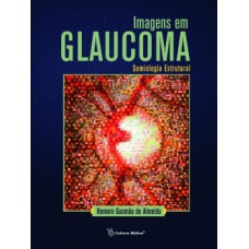 Imagens em glaucoma
