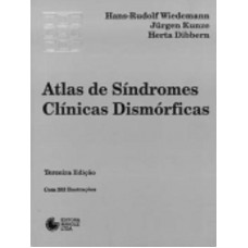 Atlas de síndromes clínicas dismórficas