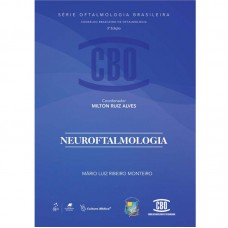 Coleção CBO - Neuroftalmologia