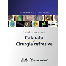 Tratado Brasileiro de Catarata e Cirurgia Refrativa