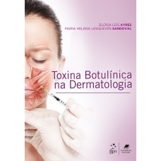 Toxina Botulínica na Dermatologia