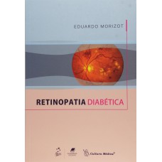 Retinopatia Diabética