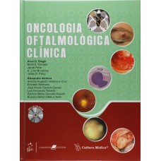 Oncologia Oftalmológica Clínica