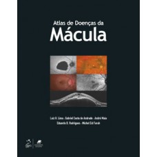 Atlas de doenças da mácula