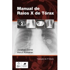 Manual de raios-x de tórax