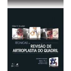 Técnicas de revisão de artroplastia do quadril