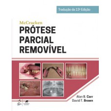 McCracken - Prótese parcial removível