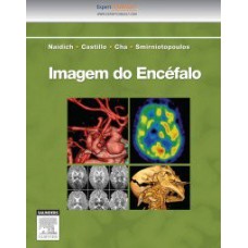 Imagem do encéfalo