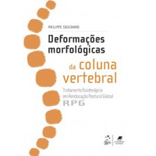 Deformações morfológicas da coluna vertebral