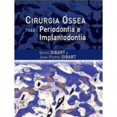 Cirurgia óssea para periodontia e implantodontia