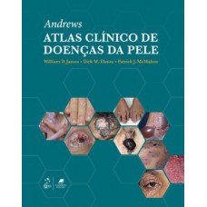 Andrew - Atlas clínico de doenças da pele