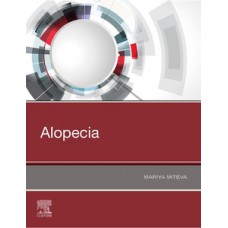 Alopecia