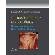 Ultrassonografia ginecológica