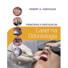 Princípios e práticas do laser na odontologia