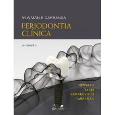 Newman e Carranza - Periodontia clínica Newman e Carranza - Periodontia clínica
