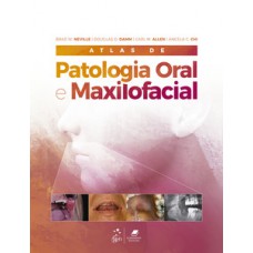 Atlas de patologia oral e maxilofacial