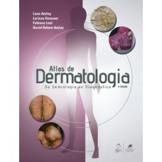 Atlas de dermatologia