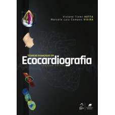 Técnicas avançadas em ecocardiografia