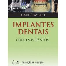 Implantes dentais contemporâneos