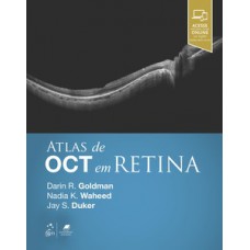 Atlas de OCT em retina Atlas de OCT em retina