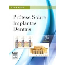 Prótese sobre implantes dentais