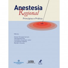 Anestesia regional