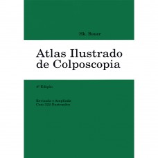 Atlas ilustrado de colposcopia