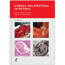 Doença inflamatória intestinal