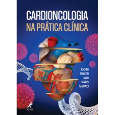 Cardioncologia na prática clínica