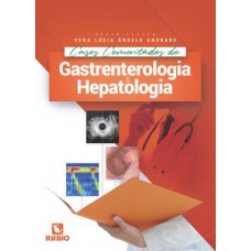 Casos comentados de gastrenterologia e hepatologia