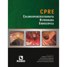 CPRE – Colangiopancreatografia retrógrada endoscópica