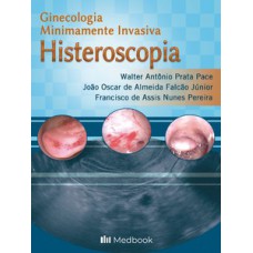 Histeroscopia - Ginecologia minimamente invasiva